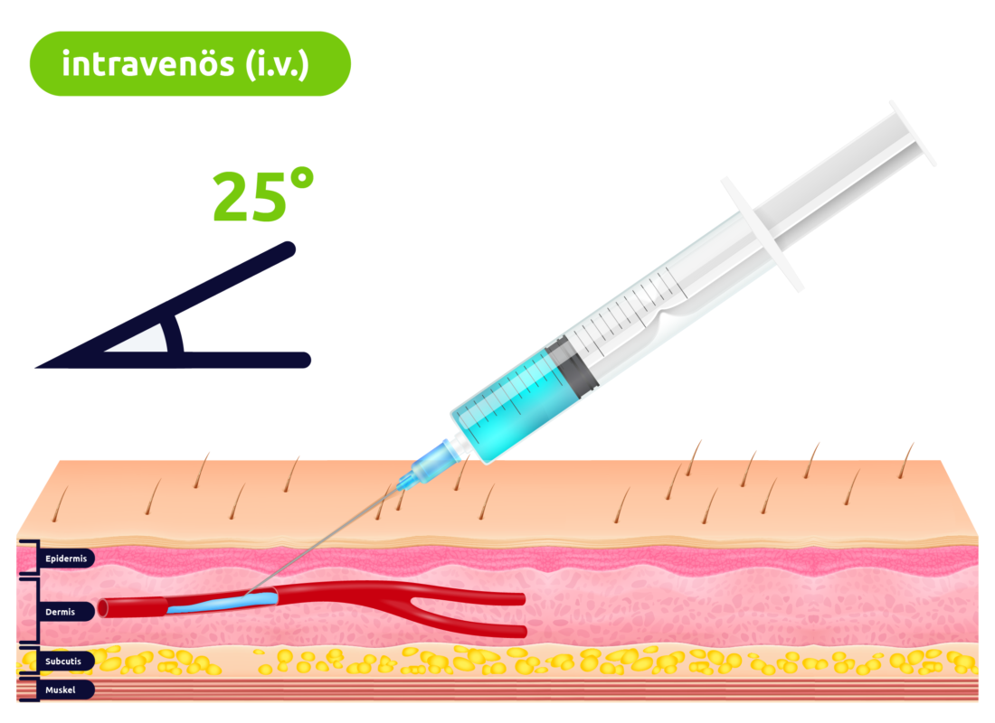 Intravenöse Injektion