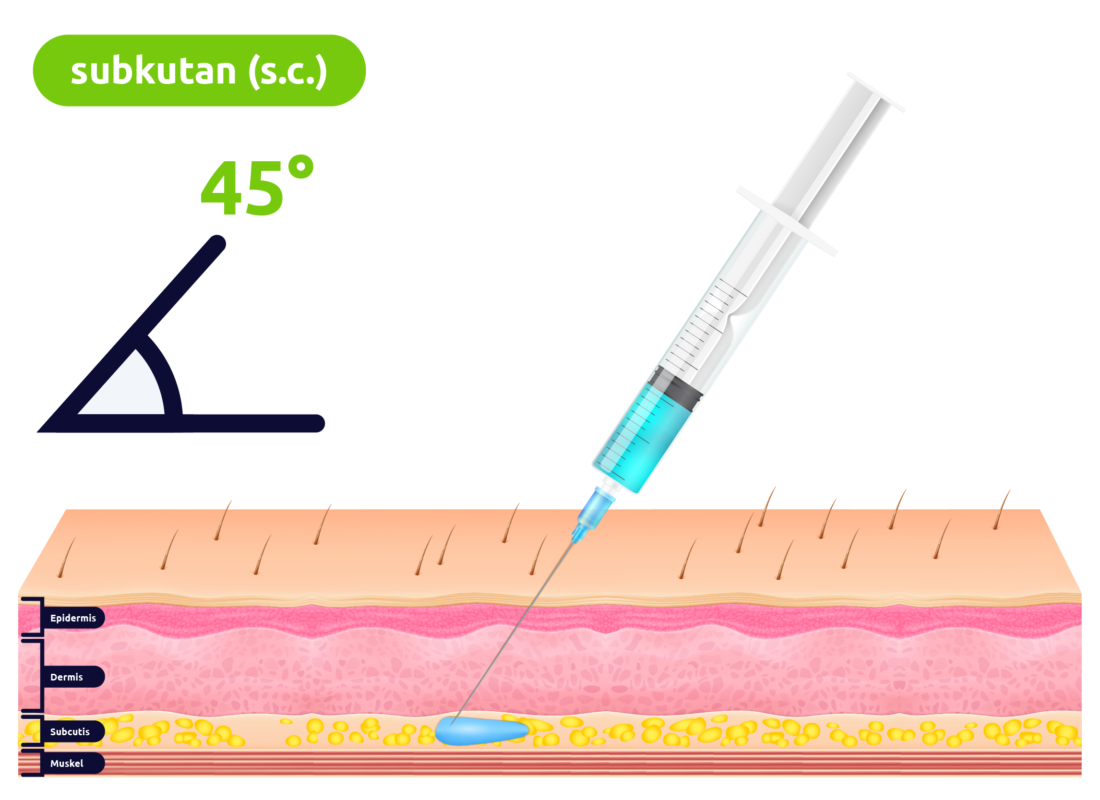 Subkutane Injektion